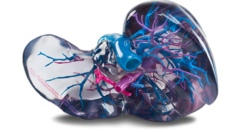 Improving Health Care with Additive - Webinar 1 stratasys 3d printed model for medical simulation