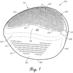 US10994177 20210504 D00001